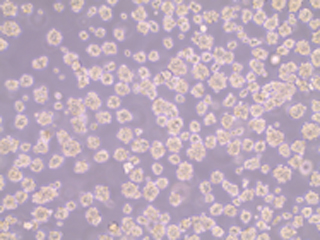 Analysis-of-Exosome-Secretion-from-Human-Mesenchymal-Stromal-Cell-Spheroids
