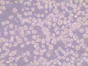 Analysis of Exosome Secretion from Human Mesenchymal Stromal Cell Spheroids