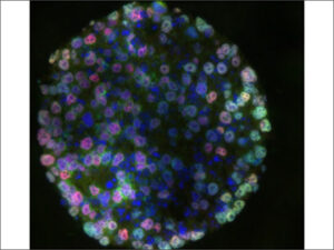 iPS spheroid culture using CellPet 3D-iPS