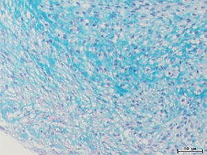 Chondrogenic differentiation from hMSC spheroids