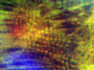 Cardiomyocyte differentiation from human iPS cells using MakCell