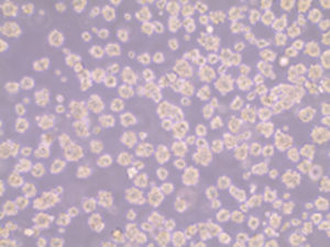 ヒト間葉系間質細胞スフェロイドのエクソソーム分泌の解析