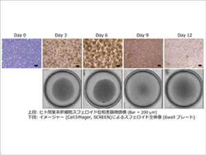 ヒト間葉系間質細胞スフェロイドの培養
