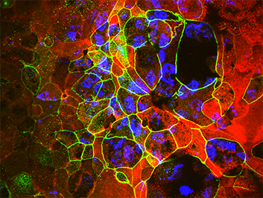 MakCellを用いた低酸素環境安定性の確認